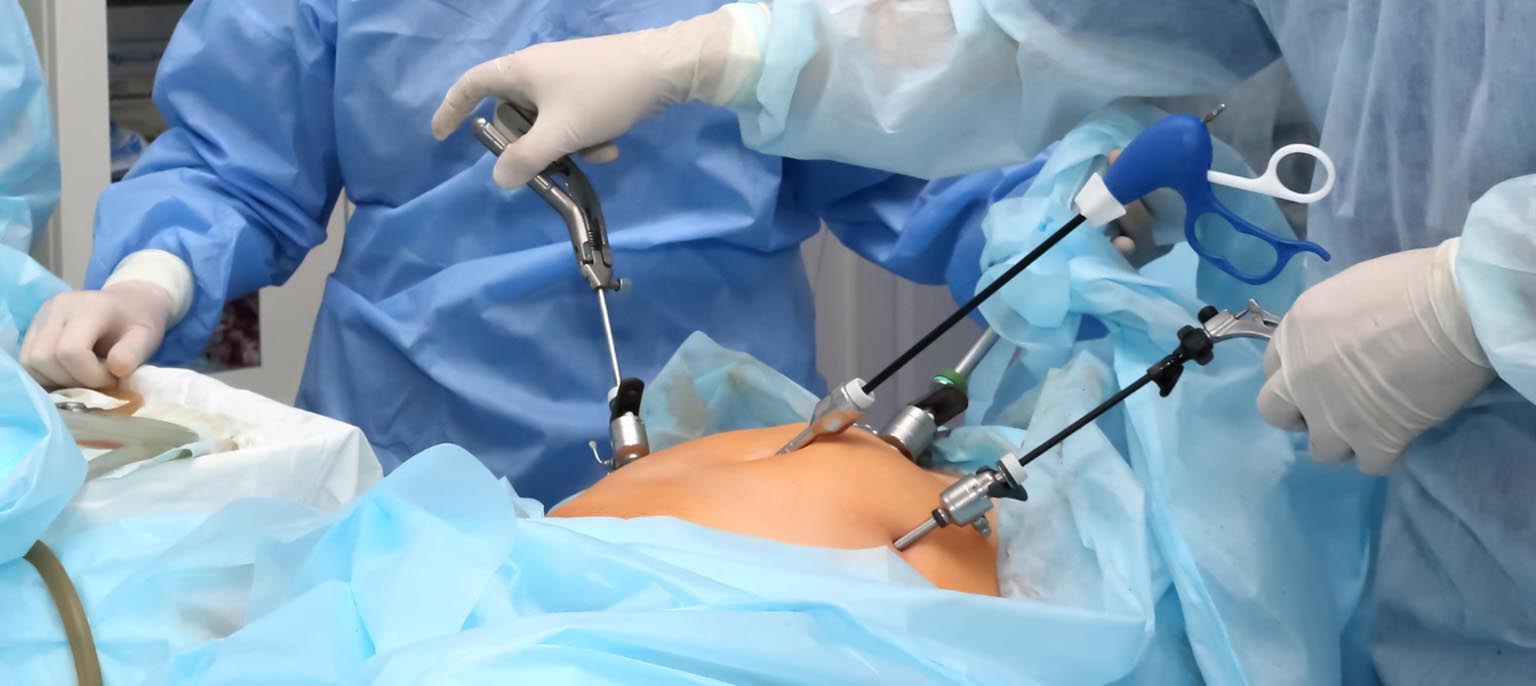 Laparoscopic